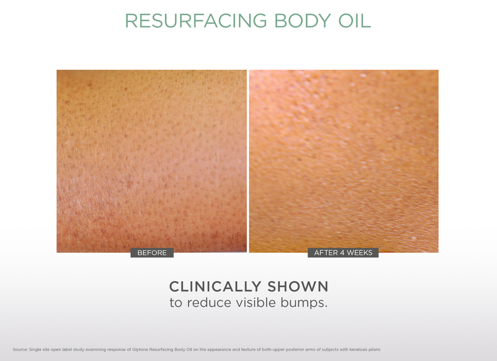 Resurfacing Body Oil