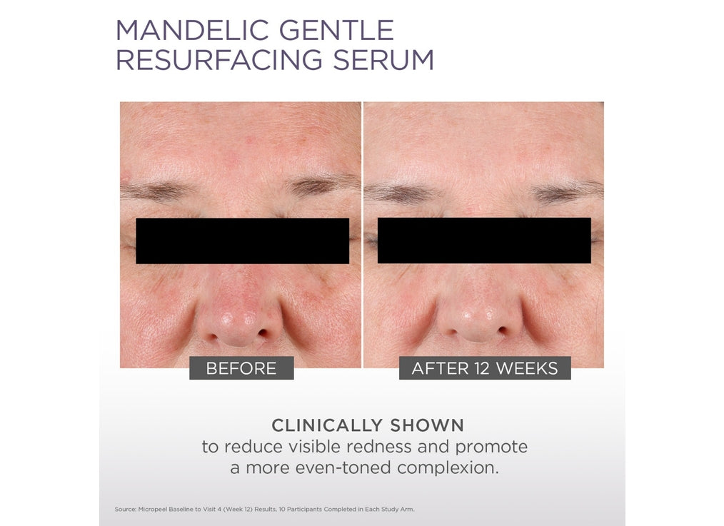 Mandelic Gentle Resurfacing Serum