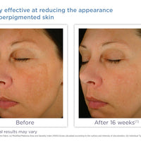 Enhance Brightening Complex