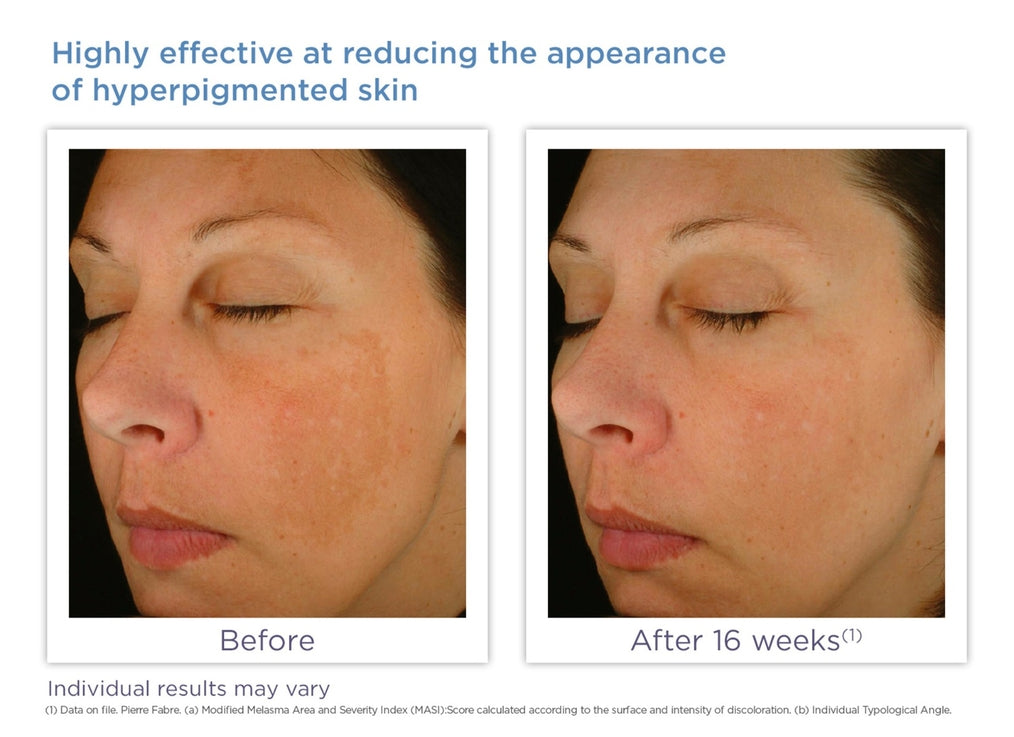 Enhance Brightening Complex