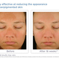 Enhance Brightening Complex