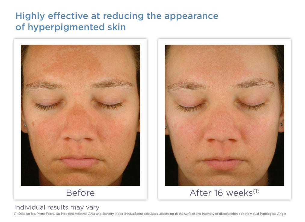 Enhance Brightening Complex