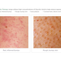 Exfoliating Body Wash