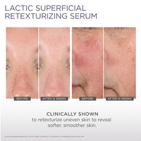Lactic Superficial Retexturizing Serum