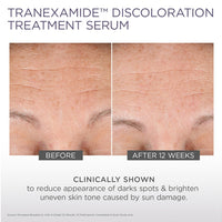 TranEXamide Discoloration Treatment Serum