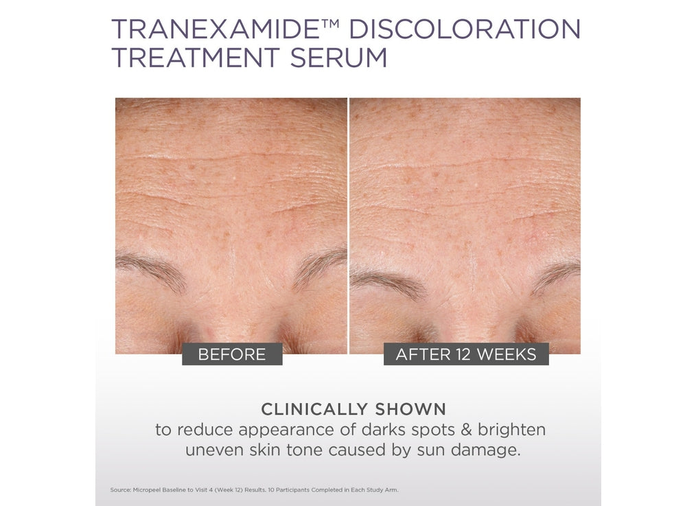 TranEXamide Discoloration Treatment Serum